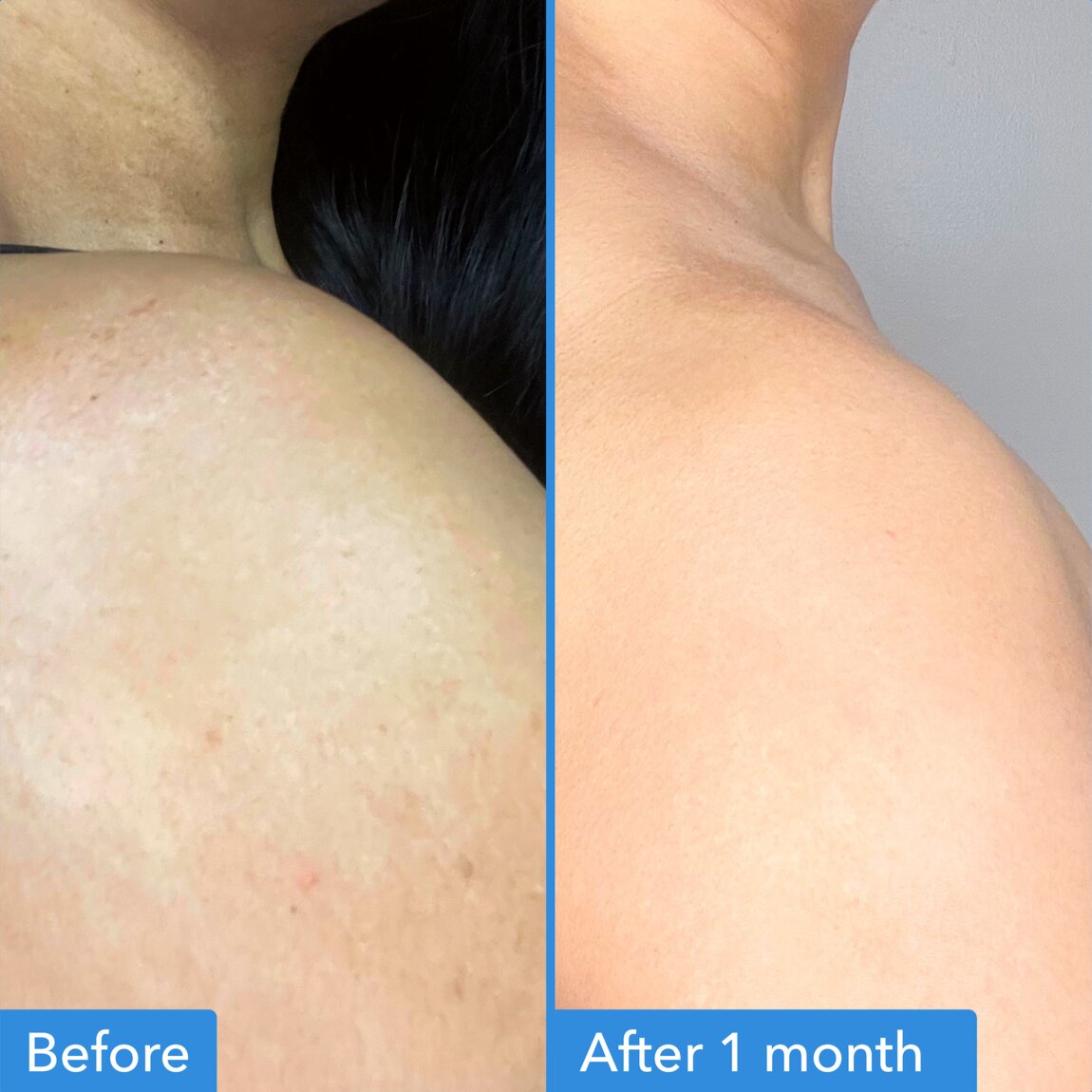 discoloration-correcting-body-treatment-t0 zb_p.jpg