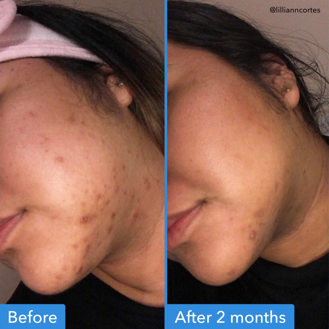discoloration-correcting-serum-b2 zb_p.jpg