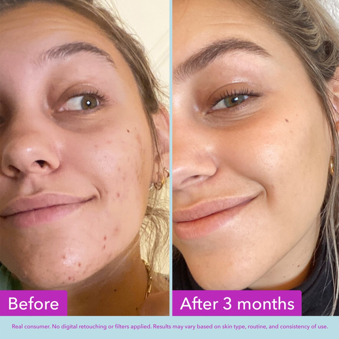niacinamide-brightening-toner-l0 zb_p.jpg