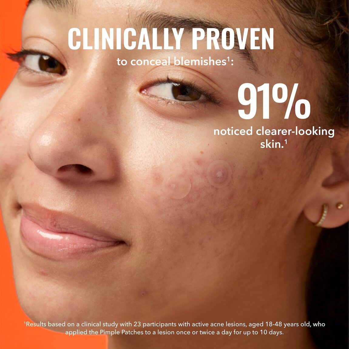 pimple-patches-k0 zb_p.jpg